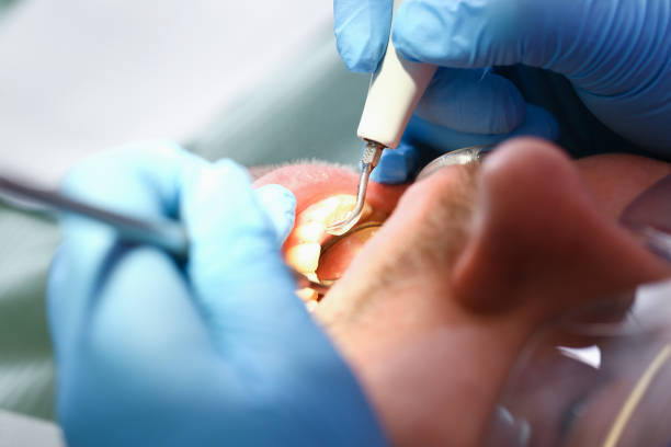 Best Emergency Gum Pain Relief  in Urbana, OH