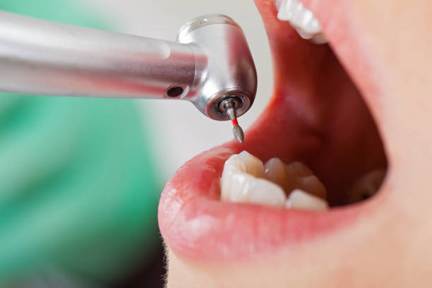 Best Cracked Tooth Emergency Dentist  in Urbana, OH